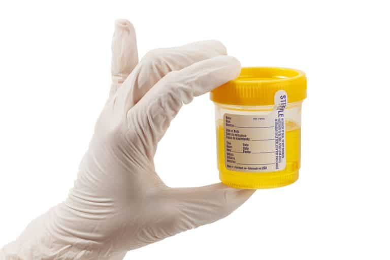 Drug Testing Options – Urine, Hair, Oral Fluid