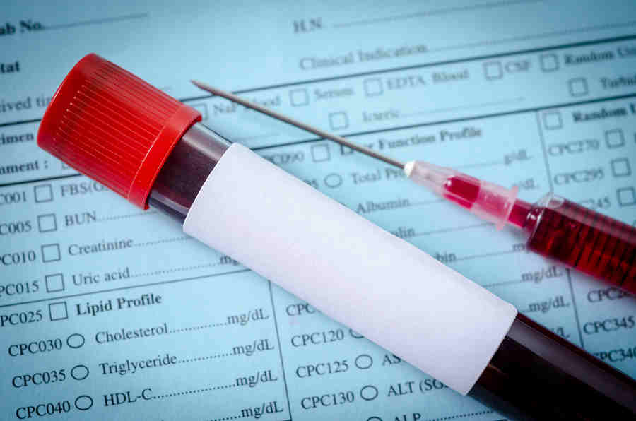 Understanding The Primary Drug Testing Methods