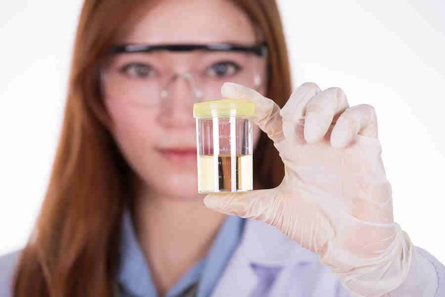 Which Drug Testing Method Do I Need To Be Aware Of?