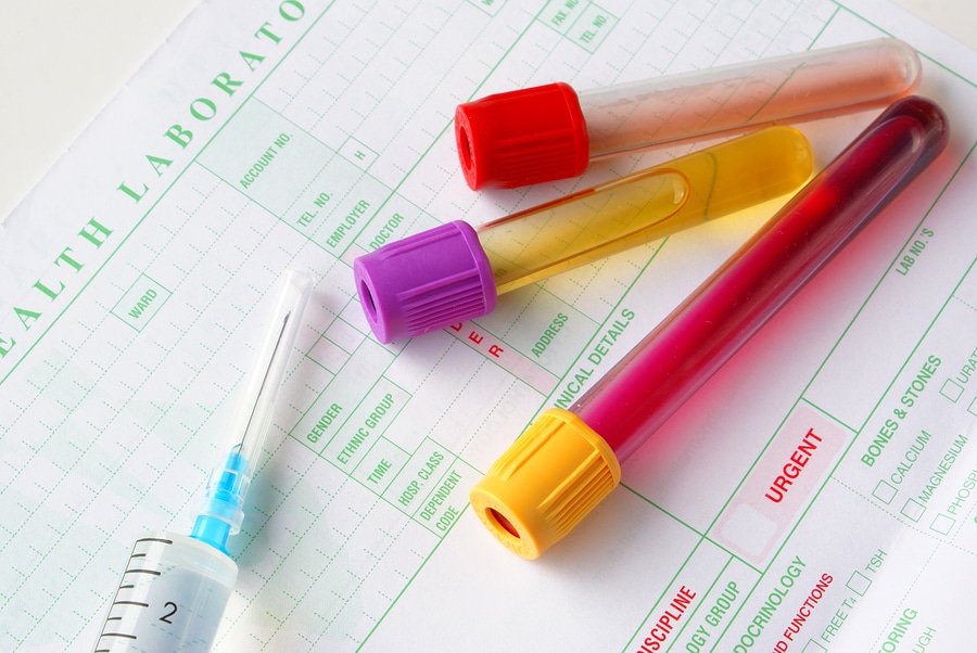 The Four Main Drug Testing Sample Options