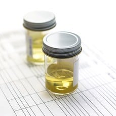Employers and Dilute Drug Test Results