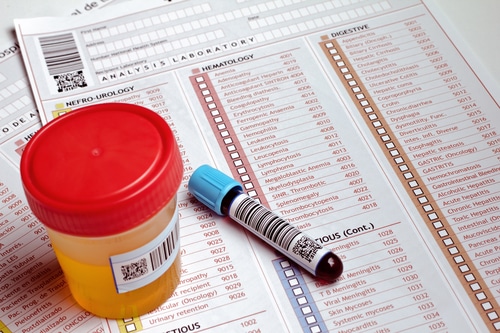 Study Shows Most Americans Support Workplace Drug Testing