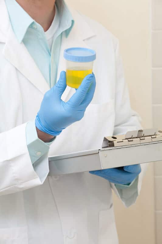 A person in a lab inspecting a urine sample