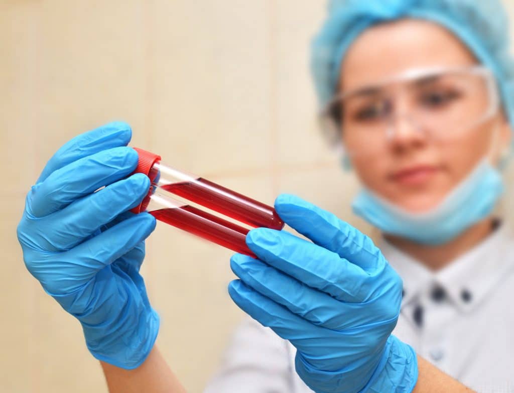 Woman holding blood samples in a vial