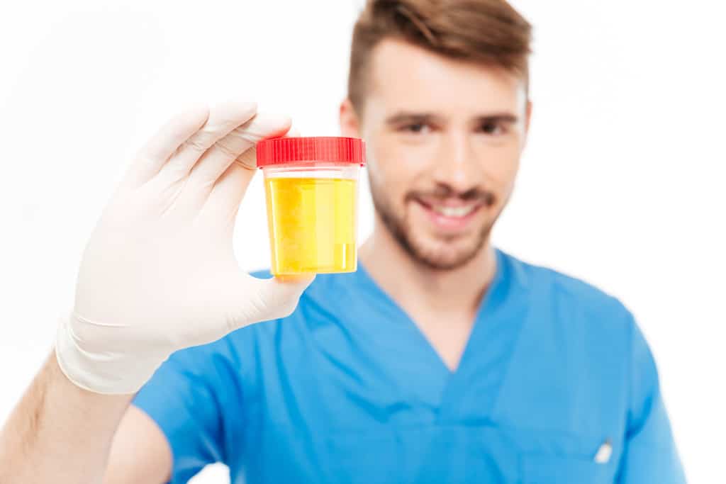 Young doctor holding urine specimen collection