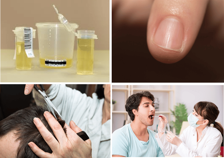 Specimen types - urine, fingernail, hair, saliva