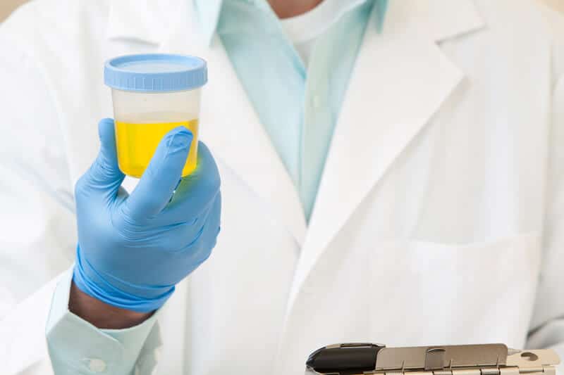 Doctor holding a urine sample